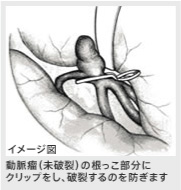 イメージ図