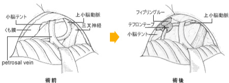 イメージ図