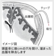 イメージ図